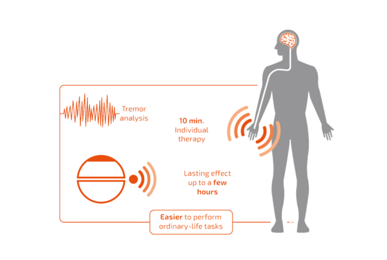 How habeo works diagram. 